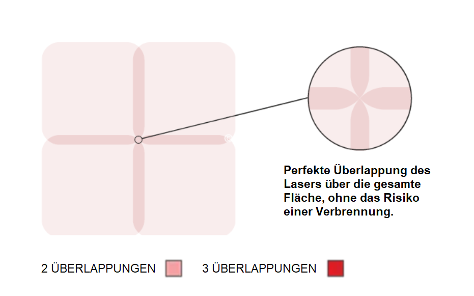 Überlappung Thunder MT Laser