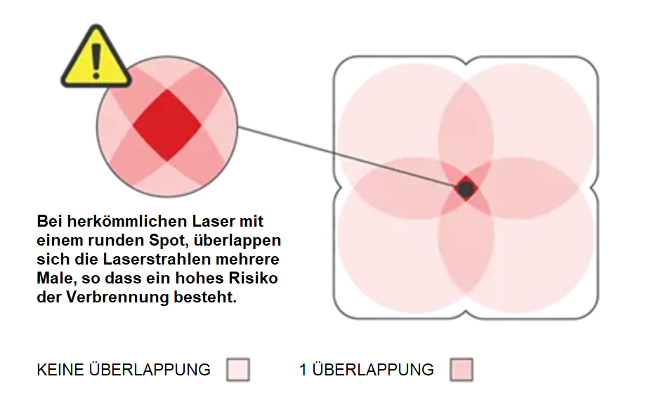 Überlappung herkömmliche Laser
